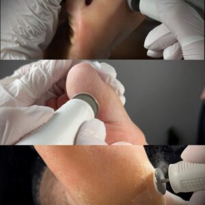 Pedicure Clean+Możliwości pododysku