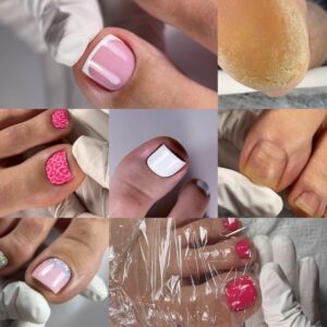 Pedicure Upgrade+Możliwości pododysku+Pedeicure frencz 